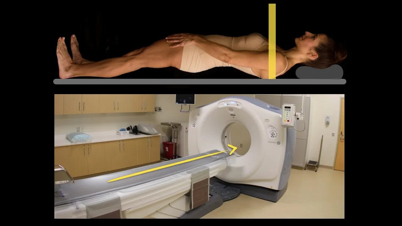 Anatomy Of CT Scans Introduction