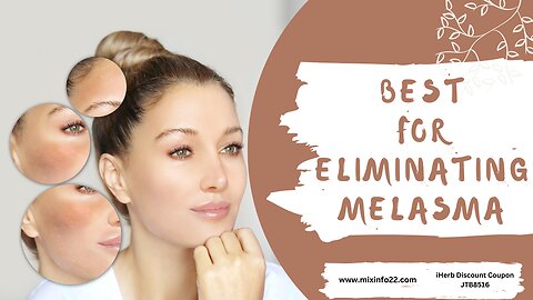Melasma | Best treatment for melasma on face #mix #melasmatreatment