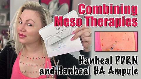 Combing Meso therapies feat. Hanheal PDRN and Hanheal HA, AceCosm | Code Jessica10 Saves you money