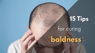 "How to combat baldness: 15 effective tips"