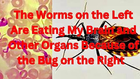 Update: Worms are Eating My Brain and Other Organs, and the Banks are Coming for Our Land