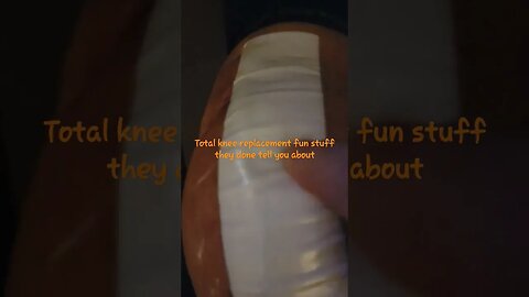 Fake kneecap meets fake knee