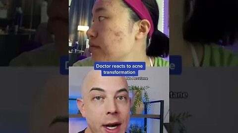 Derm reacts to amazing acne transformation without Accutane! #acne #accutane #dermreacts