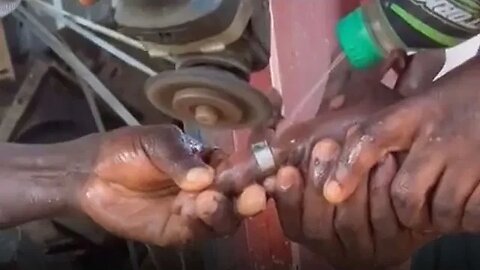 Man seen undergoing an ‘operation’ to remove a ring stuck on his finger in Ghana