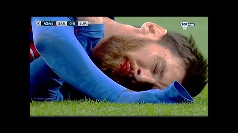 The Day Lionel Messi nearly DIED on the Pitch!