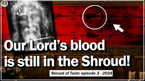 What did Jesus Suffer According to the Miraculous Shroud of Turin #Fatima #Miracle #Lent