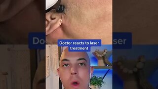 Derm reacts to incredible laser treatment! #laser #lasertreatment #dermreacts #doctorreacts