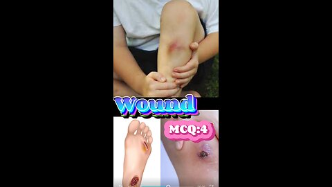 Wound MCQS #woundstage #quiz #3Dmedico #woundcare #wounddressing #medical #viral #3dmedico