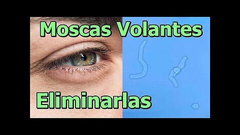 COMBATIR LAS MOSCAS VOLANTES EN LOS OJOS Y TODAS LAS CAUSAS, INCLUIDA LA EMOCIONAL