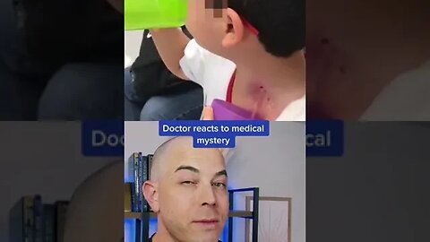 Doctor reacts to a medical mystery! #medicalmystery #dermreacts #doctorreacts