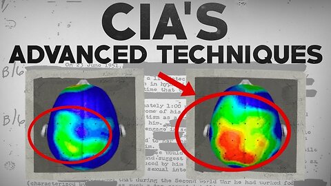 Disturbing Brain Enhancement Techniques Listed In a CIA Document