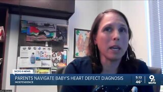 Baby with congenital heart defect defies odds