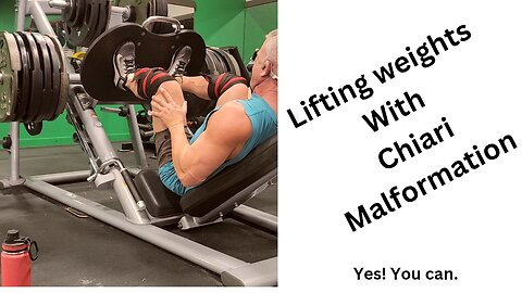 Lifting weights with Chairi Malformation
