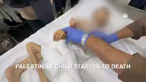 PALESTINIAN CHILD STARVES TO DEATH. WARNING: Distressing images from the start.