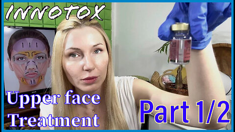 Innotox Upper face 1/2