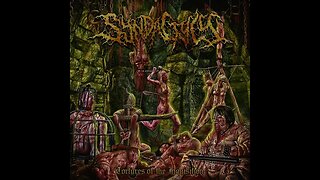 Syndactyly - Tortures Of The Inquisition (Full Album)