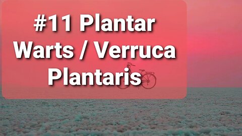 #11 Plantar Warts, Verruca Plantaris. Dr Dan Preece supporting Operation Underground Railroad.