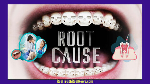 🎬🦷 Documentary: "Root Cause" - Health Issues Caused By Root Canal Procedures Such As Panic Attacks,Chronic Fatigue, Insomnia and More