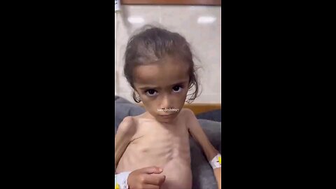 Israel is deliberately starving hundreds of thousands of little kids in Gaza.