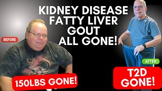How Semi-Retired Bob Cured Gout, Chronic Kidney Disease, Fatty Liver Disease and Diabetes