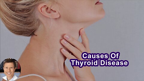The Main Cause Of Thyroid Disease In The U.S.