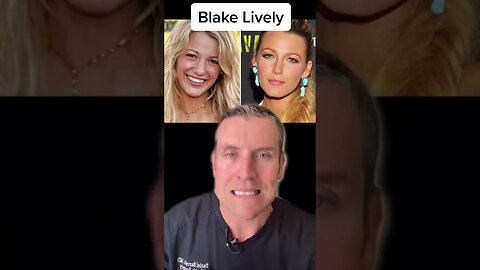 Plastic Surgery Secrets: Blake Lively! 😌✨