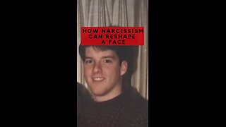 How Narcissism can Reshape a Face