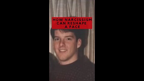How Narcissism can Reshape a Face