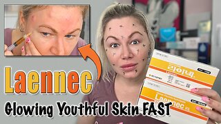 Glowing Youthful Skin FAST with Laennec! AceCosm | Code Jessica10 Saves you Money