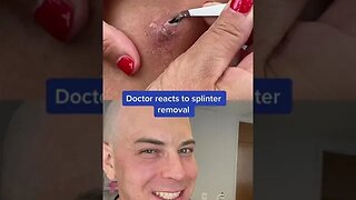 Derm reacts to MASSIVE splinter! #tree #splinter #dermreacts #doctor