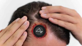 How a Neuralink Brain Implant Can Change Your Life Forever
