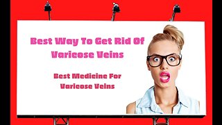Can Varicose Veins Go Away with Exercise? | What Exercise is Best for Varicose Veins.