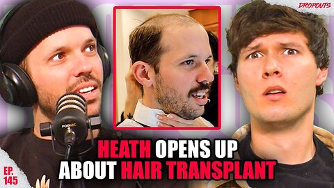 When Heath Hussar Open Up About Hair Transplant...