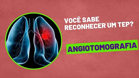 [ANGIO]: Desvendando a Angiotomografia TEP.