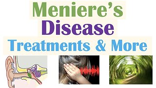 Meniere’s Disease | Pathophysiology, Triggers, Symptoms, Diagnosis, Treatment