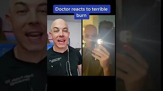 Doctor reacts to horrible sun burn! #bald #sunburn #dermreacts #doctorreacts #wearsunscreen