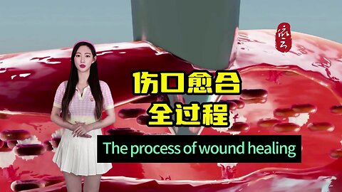 The entire process of wound healing