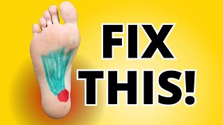 Plantar Fasciitis - A New Treatment for an Old Problem of Foot Pain