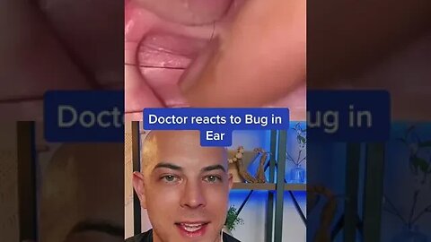 Doctor reacts to a big bug extraction out of an ear! #bug #ear #dermreacts #extraction