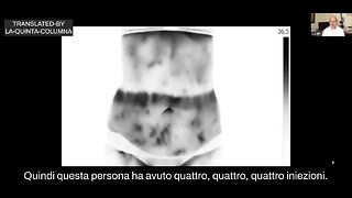 NWO, VACCINI: Termografia di vaccinati, Dottor Reitz Felipe, Effetti Avversi