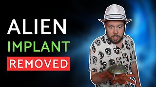 I found an alien implant in my body!