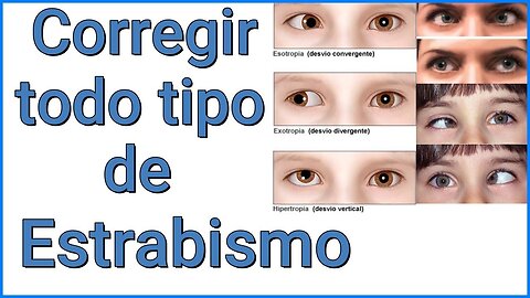 ESTRABISMO CONVERGENTE, DIVERGENTE, INTERNO, NO CONCOMITANTE, TODAS LAS CAUSAS Y CONFLICTO EMOCIONAL
