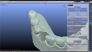 Making a lateral crown on a medit scan.