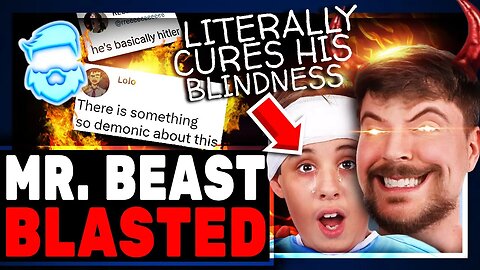 Mr Beast BLASTED For Curing Blindness In 1000 People! I Am DEAD Serious! The Left Is Outraged!