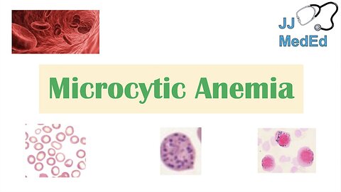 Microcytic Anemia & Causes (Iron Deficiency, Thalassemia, Anemia of Chronic Disease, Lead Poisoning)