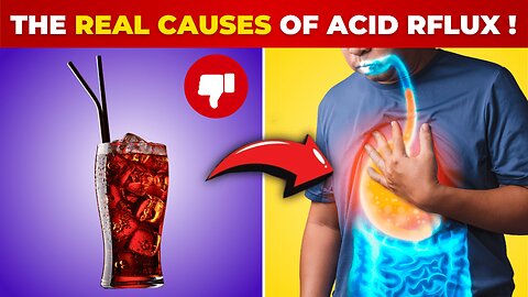 Silent REFLUX The Real Causes of ACID REFLUX