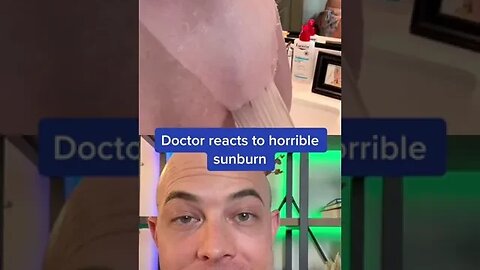 Derm reacts to horrific sunburn! #sunburn #wearsunscreen #dermreacts #doctorreacts