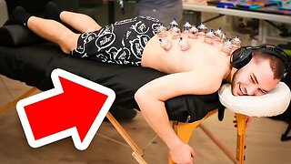 Adin Ross First Time Trying 'Cupping Therapy'