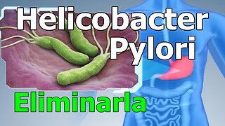 COMO ELIMINAR LA INFECCIÓN POR LA BACTERIA HELICOBACTER PYLORI