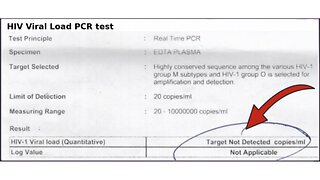 HIV PCR Test Result - HIV NOT DETECTED #2